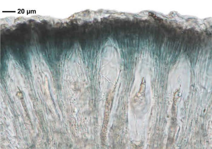 Mycoblastus affinis (Schaer.) T. Schauer, 1964