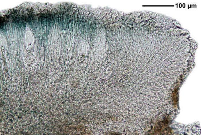 Mycoblastus affinis (Schaer.) T. Schauer, 1964