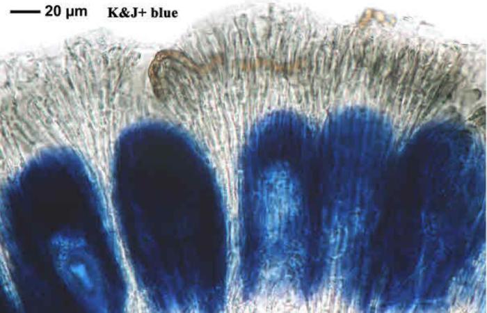 Mycoblastus affinis (Schaer.) T. Schauer, 1964
