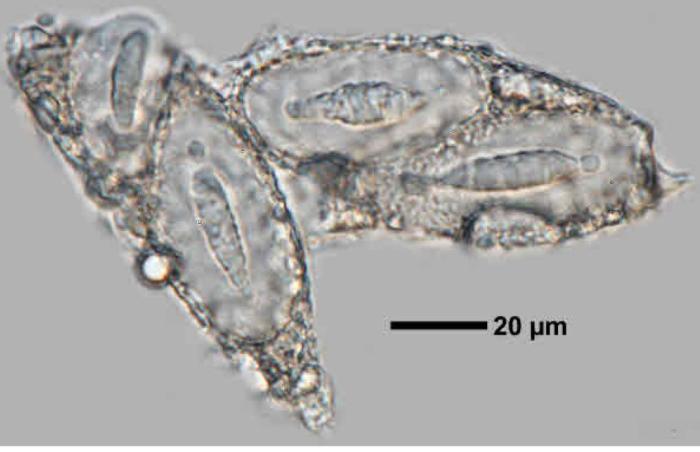 Mycoblastus affinis (Schaer.) T. Schauer, 1964