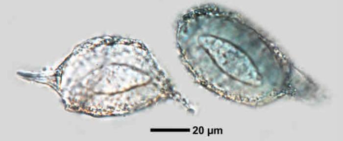 Mycoblastus affinis (Schaer.) T. Schauer, 1964