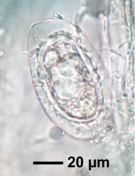 Mycoblastus affinis (Schaer.) T. Schauer, 1964