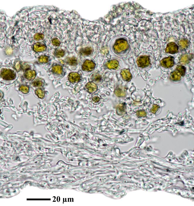 Physciella chloantha (Ach.) Essl., 1986
