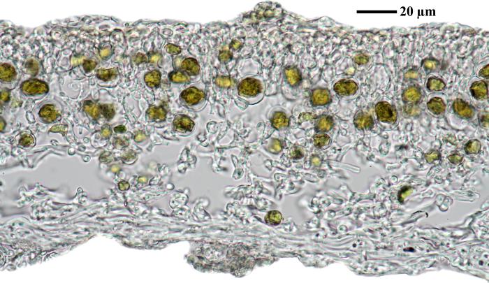 Physciella chloantha (Ach.) Essl., 1986