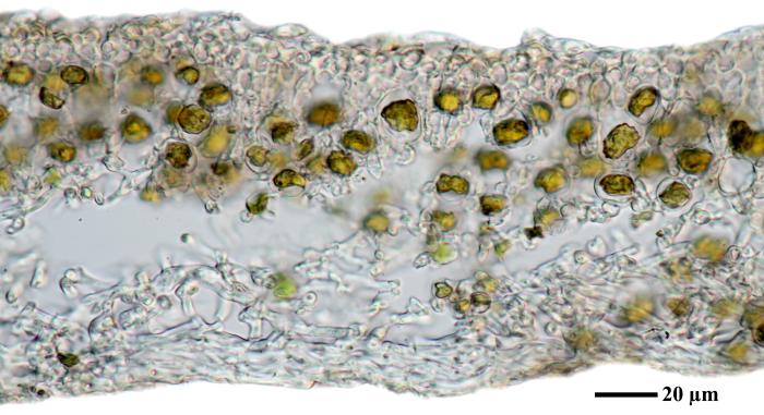Physciella chloantha (Ach.) Essl., 1986