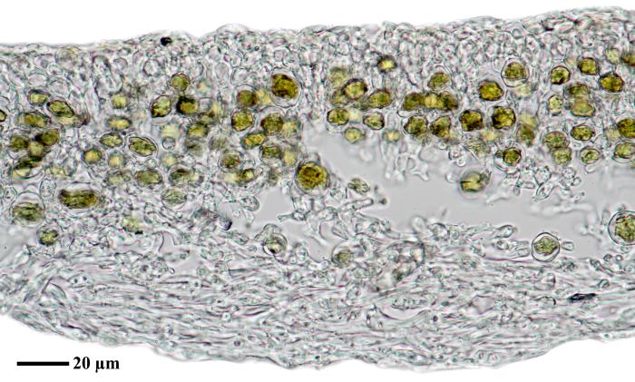 Physciella chloantha (Ach.) Essl., 1986
