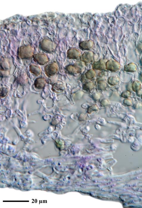 Physciella chloantha (Ach.) Essl., 1986