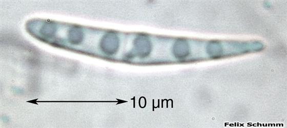 Thalloidima sedifolium (Scop.) Kistenich, Timdal, Bendiksby & S. Ekman, 2018