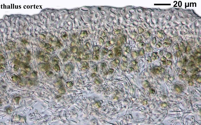Thalloidima sedifolium (Scop.) Kistenich, Timdal, Bendiksby & S. Ekman, 2018