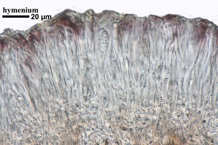 Thalloidima sedifolium (Scop.) Kistenich, Timdal, Bendiksby & S. Ekman, 2018