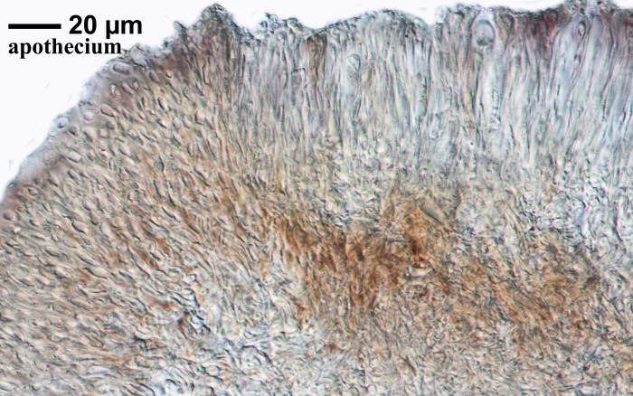 Thalloidima sedifolium (Scop.) Kistenich, Timdal, Bendiksby & S. Ekman, 2018