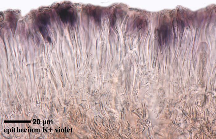 Thalloidima sedifolium (Scop.) Kistenich, Timdal, Bendiksby & S. Ekman, 2018