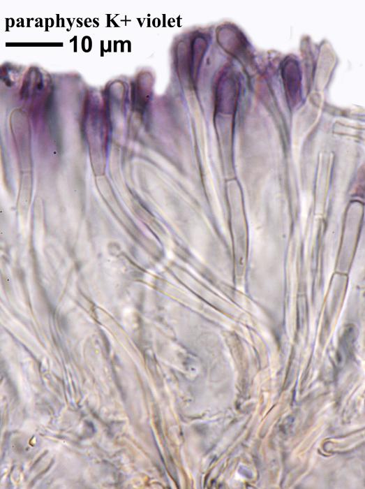 Thalloidima sedifolium (Scop.) Kistenich, Timdal, Bendiksby & S. Ekman, 2018