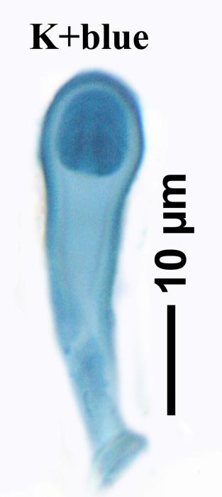 Thalloidima sedifolium (Scop.) Kistenich, Timdal, Bendiksby & S. Ekman, 2018