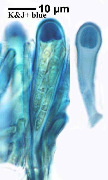 Thalloidima sedifolium (Scop.) Kistenich, Timdal, Bendiksby & S. Ekman, 2018