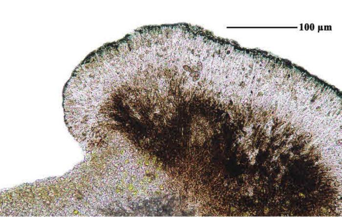 Epilichen scabrosus (Ach.) Clem., 1909