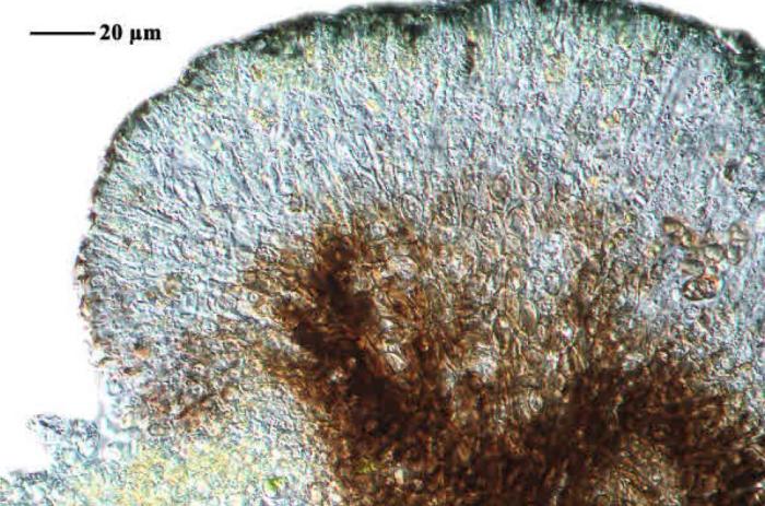 Epilichen scabrosus (Ach.) Clem., 1909