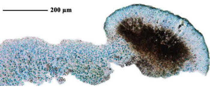 Epilichen scabrosus (Ach.) Clem., 1909