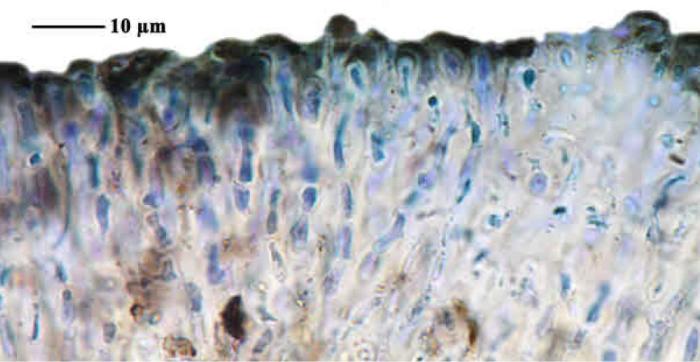 Epilichen scabrosus (Ach.) Clem., 1909