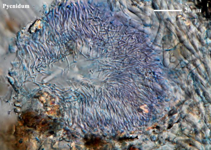 Die fertile Form mit Apothecien und ohne Sorale (früher Roccella canariensis genannt). Cortex mit textura intricata. Chemistry: Cortex C-, Subcortex C+ rot, Medulla C-, J+ blau. Sporen 3-septiert, farblos, 8/Ascus, 21.5-25 x 5-5.5 μm / © Felix Schumm