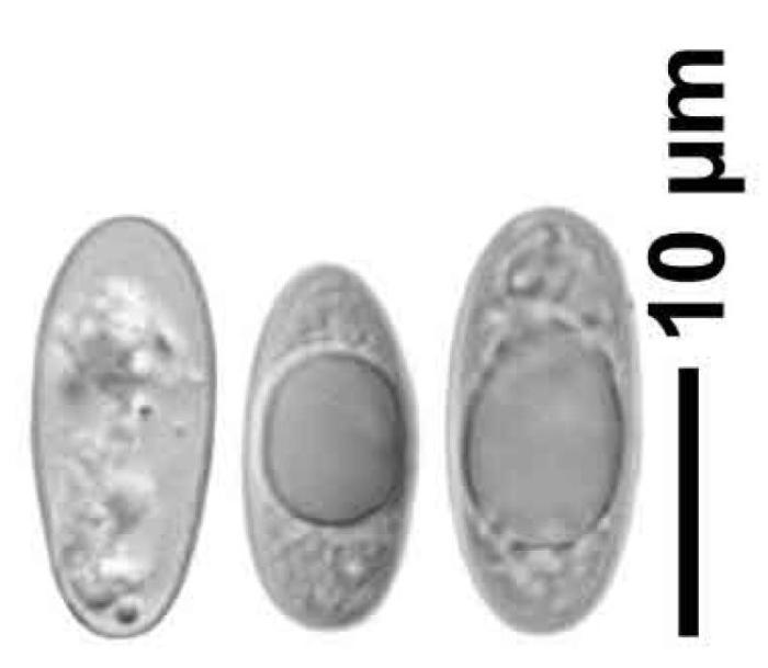 Trapelia coarctata (Turner ex Sm.) M. Choisy, 1932
