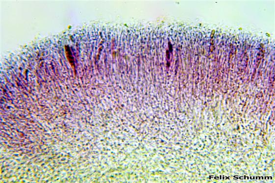 Trapeliopsis flexuosa (Fr.) Coppins & P. James, 1984