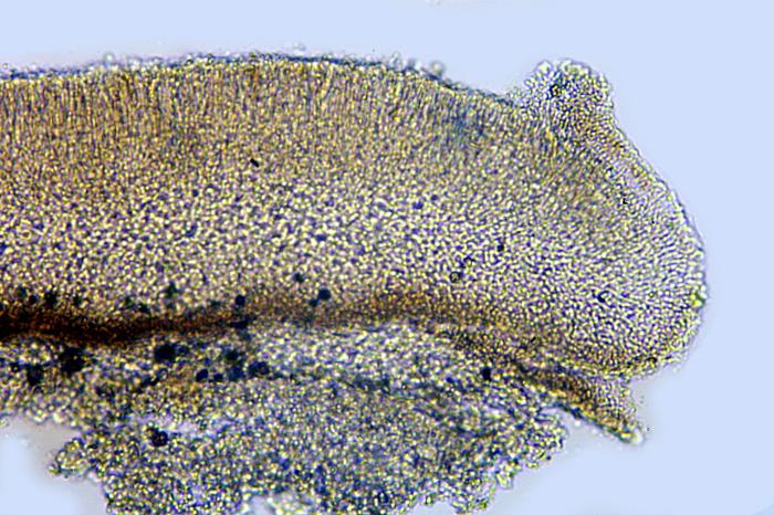 Trapeliopsis flexuosa (Fr.) Coppins & P. James, 1984