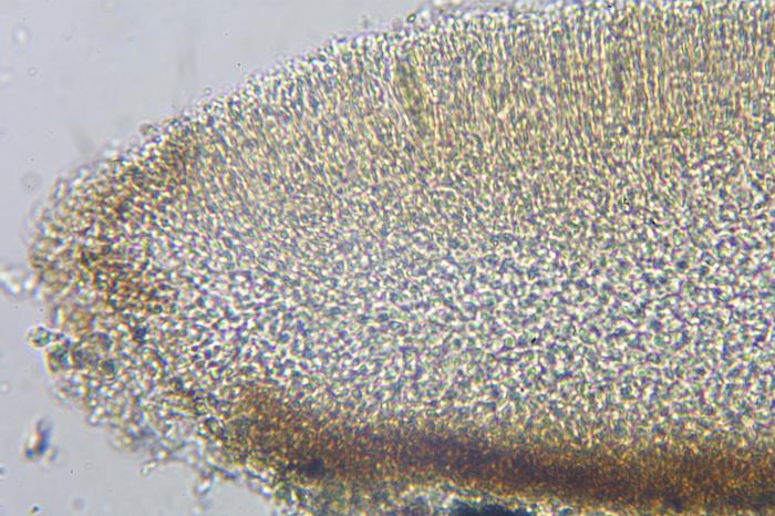 Trapeliopsis flexuosa (Fr.) Coppins & P. James, 1984
