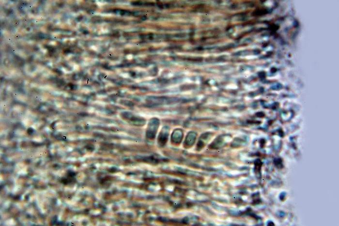 Trapeliopsis flexuosa (Fr.) Coppins & P. James, 1984
