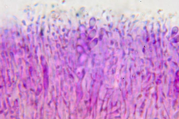 Trapeliopsis flexuosa (Fr.) Coppins & P. James, 1984