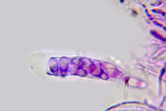 Trapeliopsis flexuosa (Fr.) Coppins & P. James, 1984