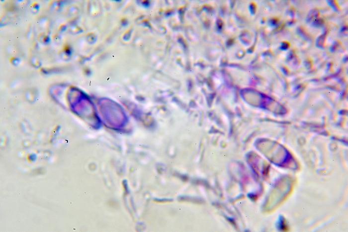 Trapeliopsis flexuosa (Fr.) Coppins & P. James, 1984