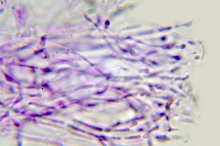 Trapeliopsis flexuosa (Fr.) Coppins & P. James, 1984