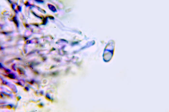 Trapeliopsis flexuosa (Fr.) Coppins & P. James, 1984