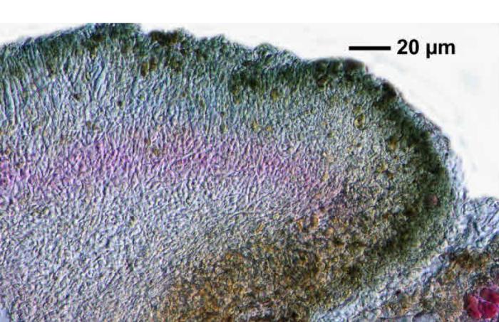 Trapeliopsis flexuosa (Fr.) Coppins & P. James, 1984