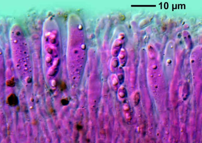 Trapeliopsis flexuosa (Fr.) Coppins & P. James, 1984