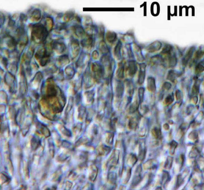 Trapeliopsis flexuosa (Fr.) Coppins & P. James, 1984