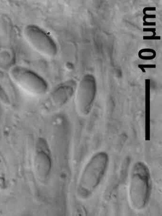 Trapeliopsis flexuosa (Fr.) Coppins & P. James, 1984