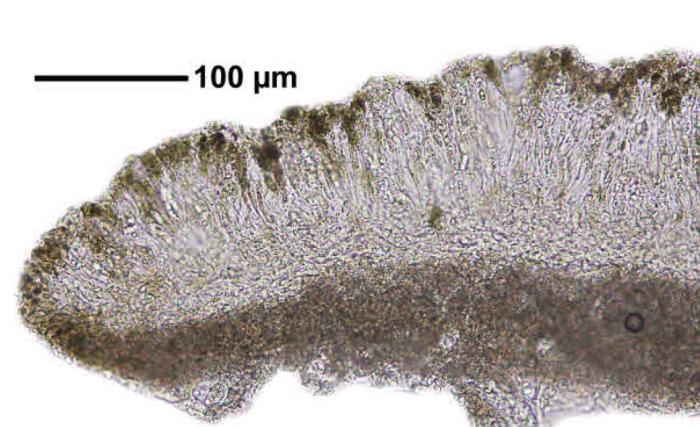 Trapeliopsis granulosa (Hoffm.) Lumbsch, 1983