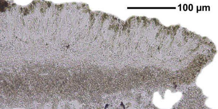 Trapeliopsis granulosa (Hoffm.) Lumbsch, 1983