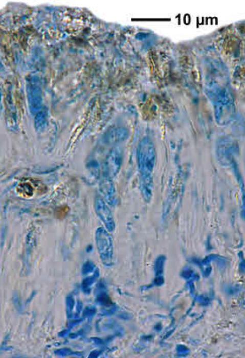 Trapeliopsis granulosa (Hoffm.) Lumbsch, 1983