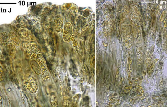 Trapeliopsis granulosa (Hoffm.) Lumbsch, 1983