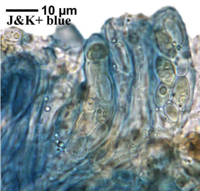 Trapeliopsis granulosa (Hoffm.) Lumbsch, 1983