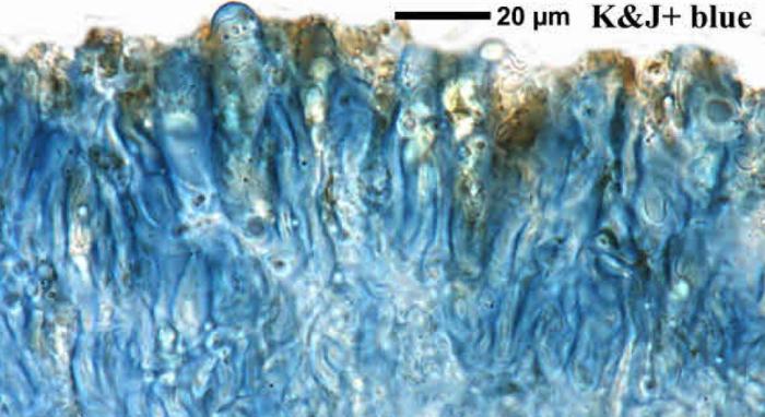 Trapeliopsis granulosa (Hoffm.) Lumbsch, 1983