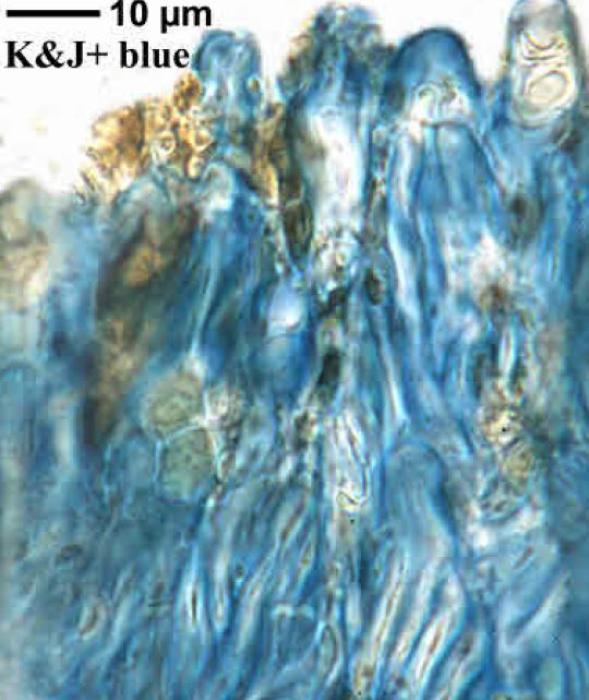 Trapeliopsis granulosa (Hoffm.) Lumbsch, 1983