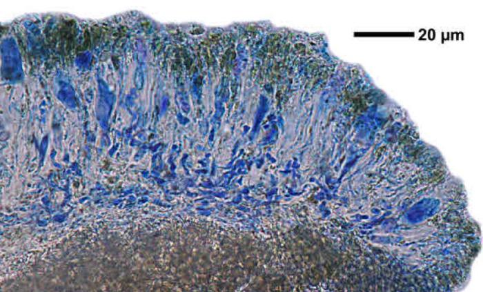 Trapeliopsis granulosa (Hoffm.) Lumbsch, 1983