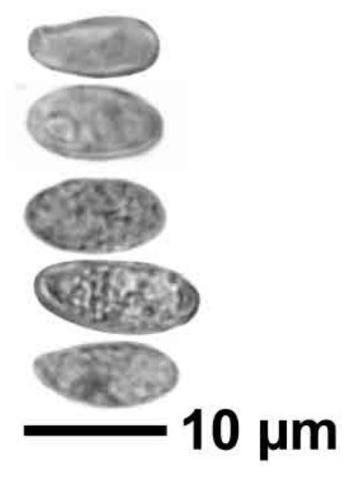 Trapeliopsis granulosa (Hoffm.) Lumbsch, 1983