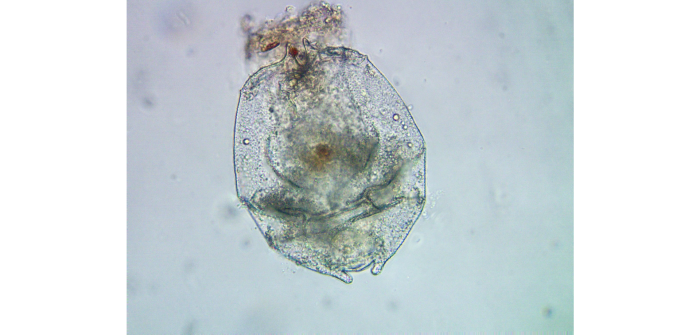 Brachionus angularis Gosse, 1851