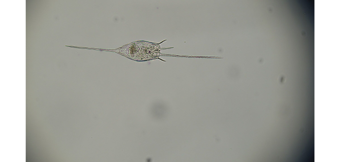 Kellicottia bostoniensis (Rousselet, 1908)