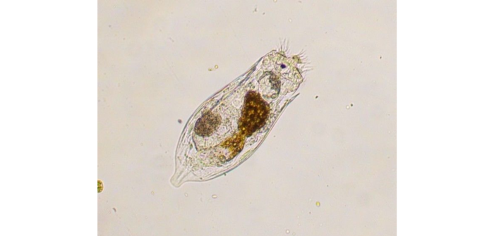 Notholca acuminata (Ehrenberg, 1832)